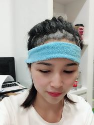 -大麦微针植发全国连锁