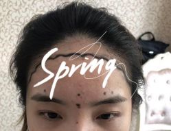 -大麦微针植发全国连锁