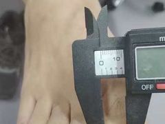 -祖传修脚甲沟炎灰指甲鸡眼