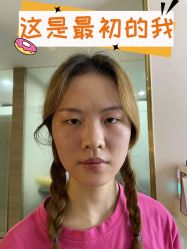 -素美医疗美容·西南眼鼻整形·修复基地