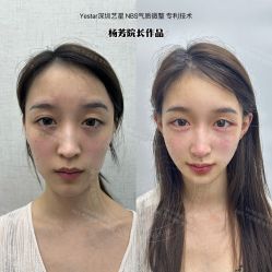 -深圳艺星医疗美容医院