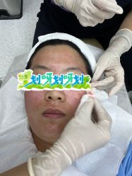 体验后-Dr.U博士医疗美容医院