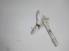 -昆明爱尔眼科医院