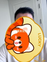 -大麦微针植发丨全国连锁