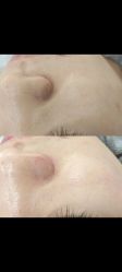 -SKIN79皮肤管理中心