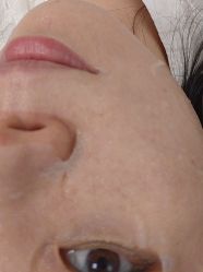 -深圳春天阳光医院·轮廓抗衰中心