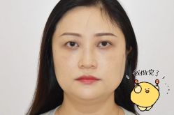 -广州健丽·去眼袋医疗美容机构