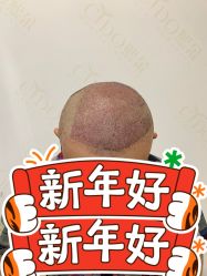 -熙朵美学植发连锁