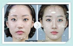 -SKINIST丽铂医疗美容