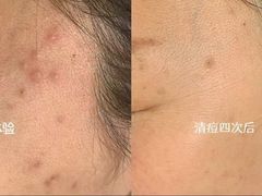 -中粮·祥云小镇