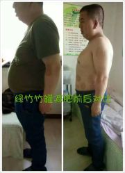 -绿竹·竹罐瘦身养生馆