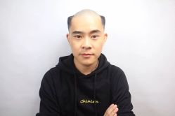 -发饰美男士增发补发假发定制店