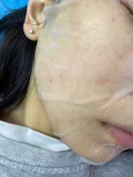 体验后-杭州米兰柏羽医疗美容医院