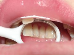 -思诺口腔(牛市口店)