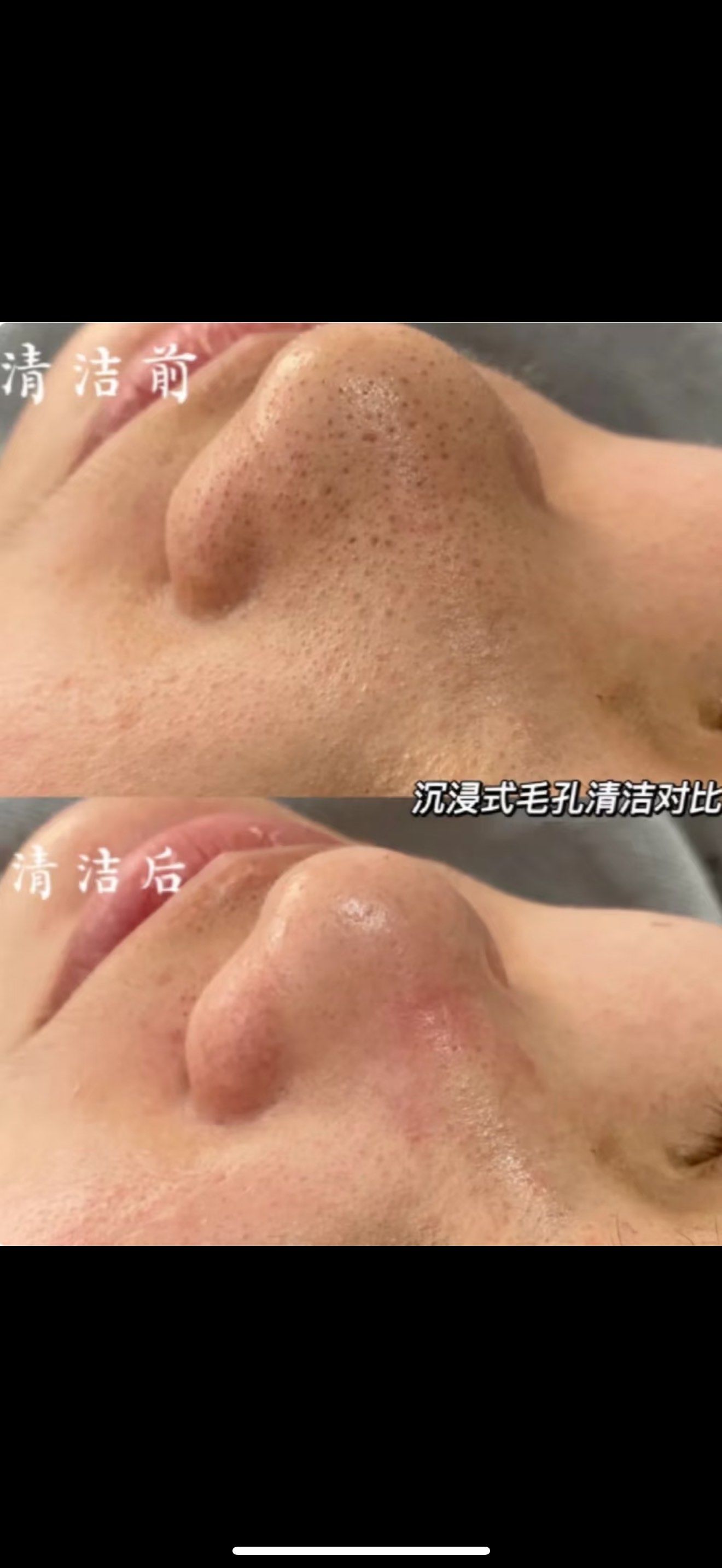 毛孔深层净化 ✨