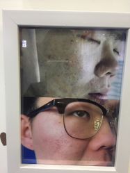 -蕾特恩专业祛痘国际连锁