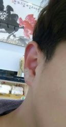 -溢美古法抗衰
