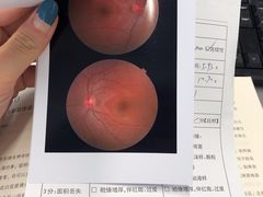 -上海市眼病防治中心(康定路院区)