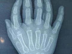 -华中科技大学同济医学院附属协和医院(主院区)