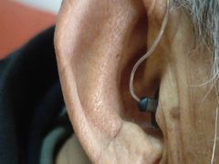 -北京悦听品牌助听器集合店峰力奥迪康斯达克瑞声达(石景山店)