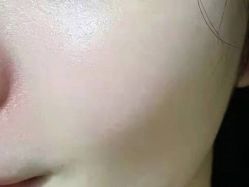 -郑荃丽格医疗美容