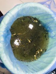 -德哥灰指甲脚气甲沟炎跖疣护理