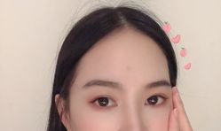 -广州美莱医疗美容医院