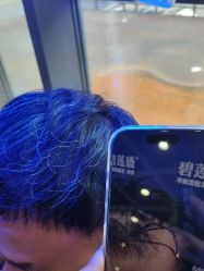 -碧莲盛·不剃发植发