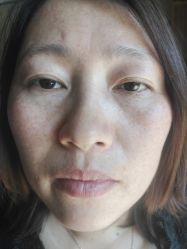 体验后-上海锦妍医疗美容门诊部