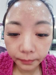 体验后-美莱医学美容医院