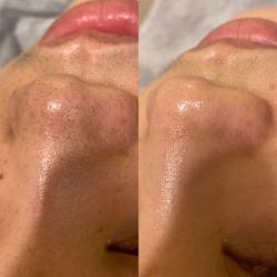 体验后-艾尚妮·美容美体SPA