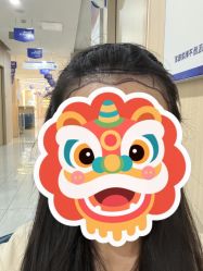 -碧莲盛不剃发植发