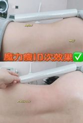 -Lily纤美·科技减脂中心
