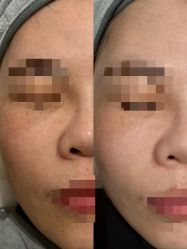 体验前-SKIN79皮肤管理中心