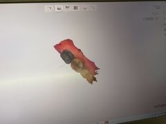 -上海仁爱医院口腔科 · 种植