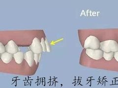 -团圆口腔·种植中心(锦江院区)