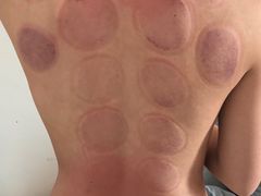-张钰强中医正骨推拿连锁(华发商都店)