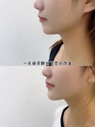 -上海漾颜医疗美容