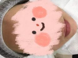 -悟空祛痘·诺奖技术专业店