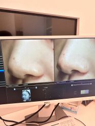 -苑苑vbeauty科技美容SPA