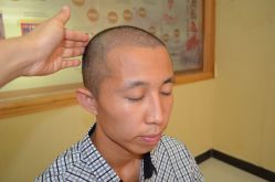 -大麦微针植发丨全国连锁