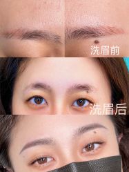 点击看大图 -杨益美学·野生眉半永久纹眉发际线