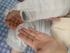 -广州中医药大学第三附属医院(骨伤科分院)