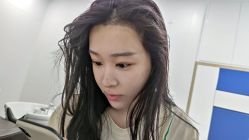 -大麦微针植发全国连锁