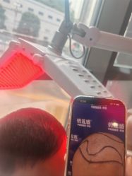 -碧莲盛·不剃发植发