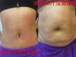点击看大图 -香薇妮丝女子减肥院