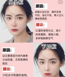 -凡碧诗毛孔清洁收细