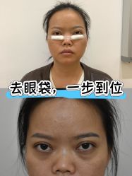 -广州健丽·去眼袋医疗美容机构