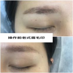 -MLP美丽派·问题肌疗愈中心