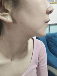 -北京美痣堂古方祛痣斑疣瘊